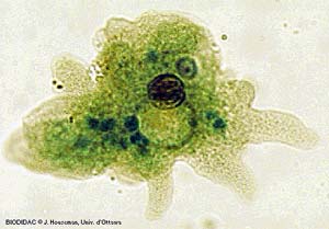 Amoeba, showing lobopodia (BIODIDAC)