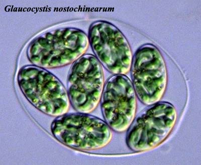 Glaucocystis