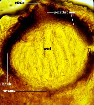 perithecium within a locule