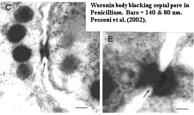 Woronin bodies from Pessoni et al. (2002)