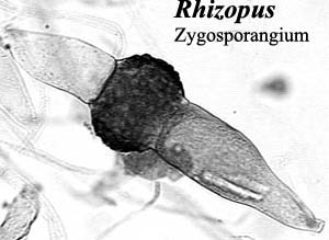 Zygosporangium of Rhizopus