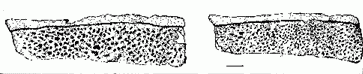 Typothorax paramedian plates
