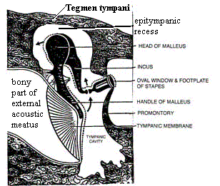 Human middle ear with tegmen tympani