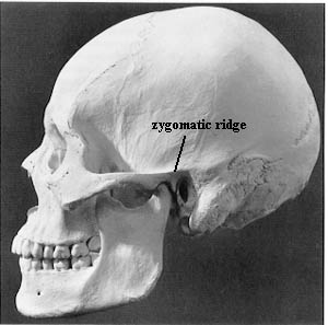 zygomatic ridge