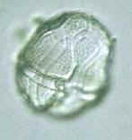 Peridinium (cell with theca)