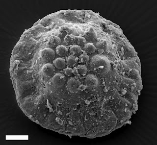 Phosphatic palaeoscolecid Hadimopanella