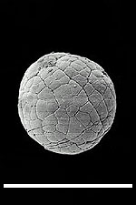 Indet. Cambrian embryo (14261 bytes)