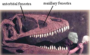 maxillary fenestra