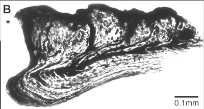 vertical section of arthrodire gnathal plate